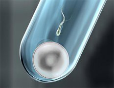 第三代试管婴儿PGD可以筛查出哪些遗传疾病?